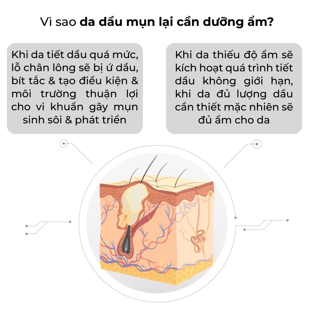 Blog_kem dưỡng ẩm cho da dầu mụn-02