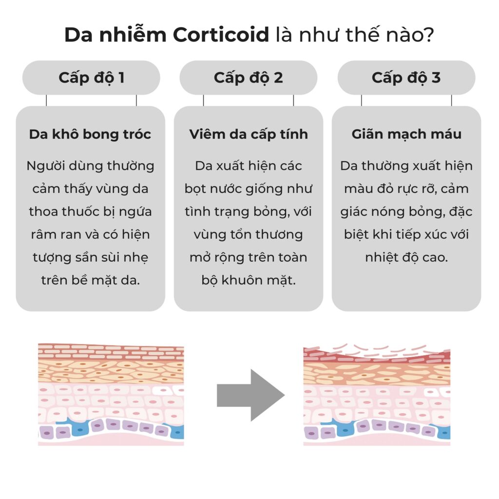 blog rejuve _ Da nhiễm Corticoid _ 2