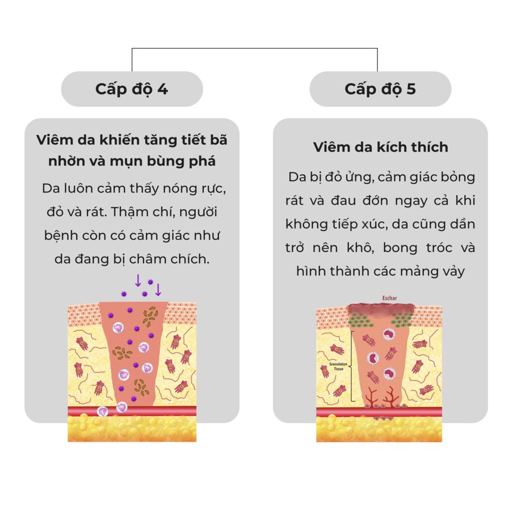 blog rejuve _ Da nhiễm Corticoid _ 3