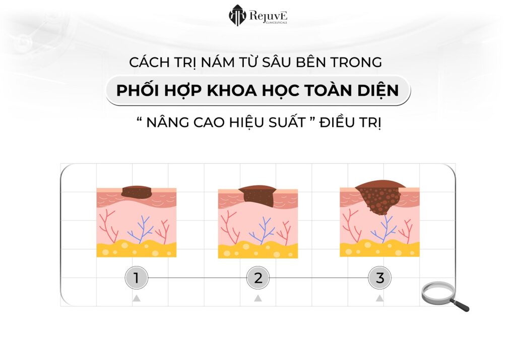 Blog_cách trị nám từ bên trong-01